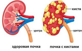 Поликистоз почек у кошек и котов
