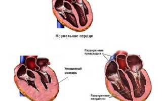 Признаки болезни сердца у кошек